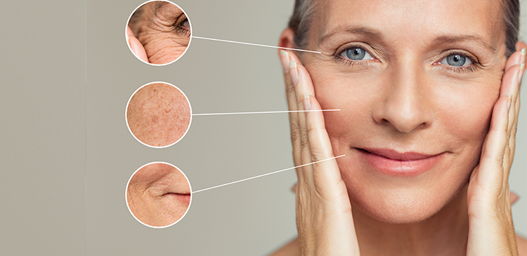 Preventing Fine Lines and Wrinkles