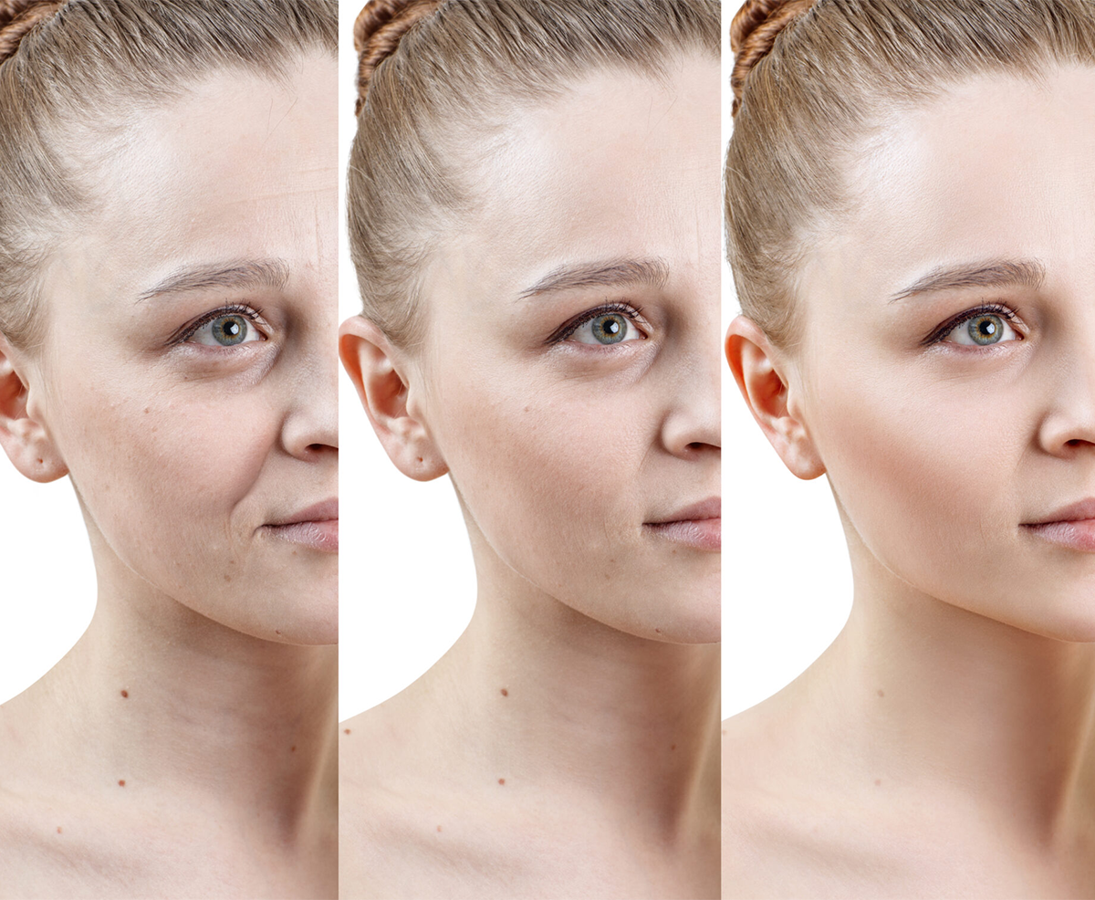 Woman in three stages of using skincare. Before, during, after